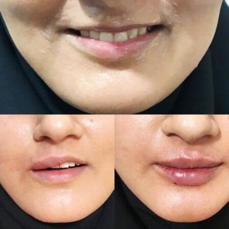 زیبایی غیرجراحی — نمونه