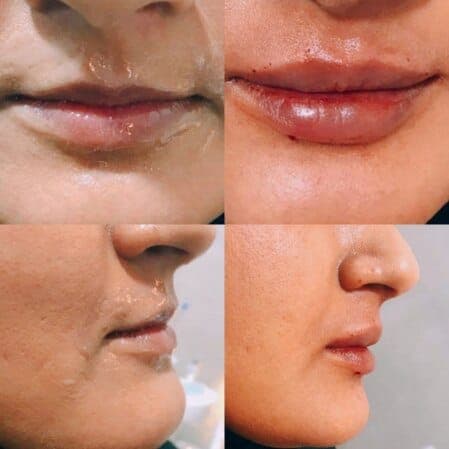 زیبایی غیرجراحی — نمونه