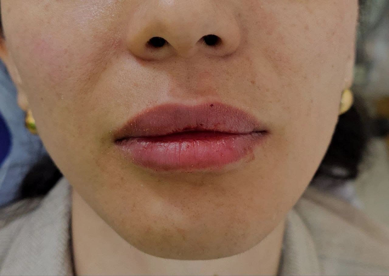 زیبایی غیرجراحی — نمونه