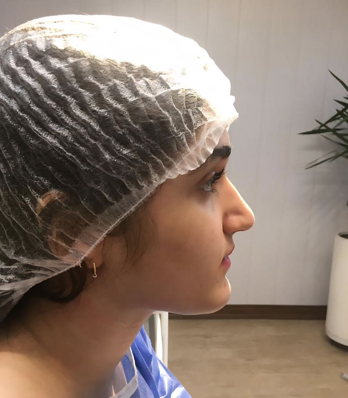 جراحی بینی و زیبایی صورت — نمونه