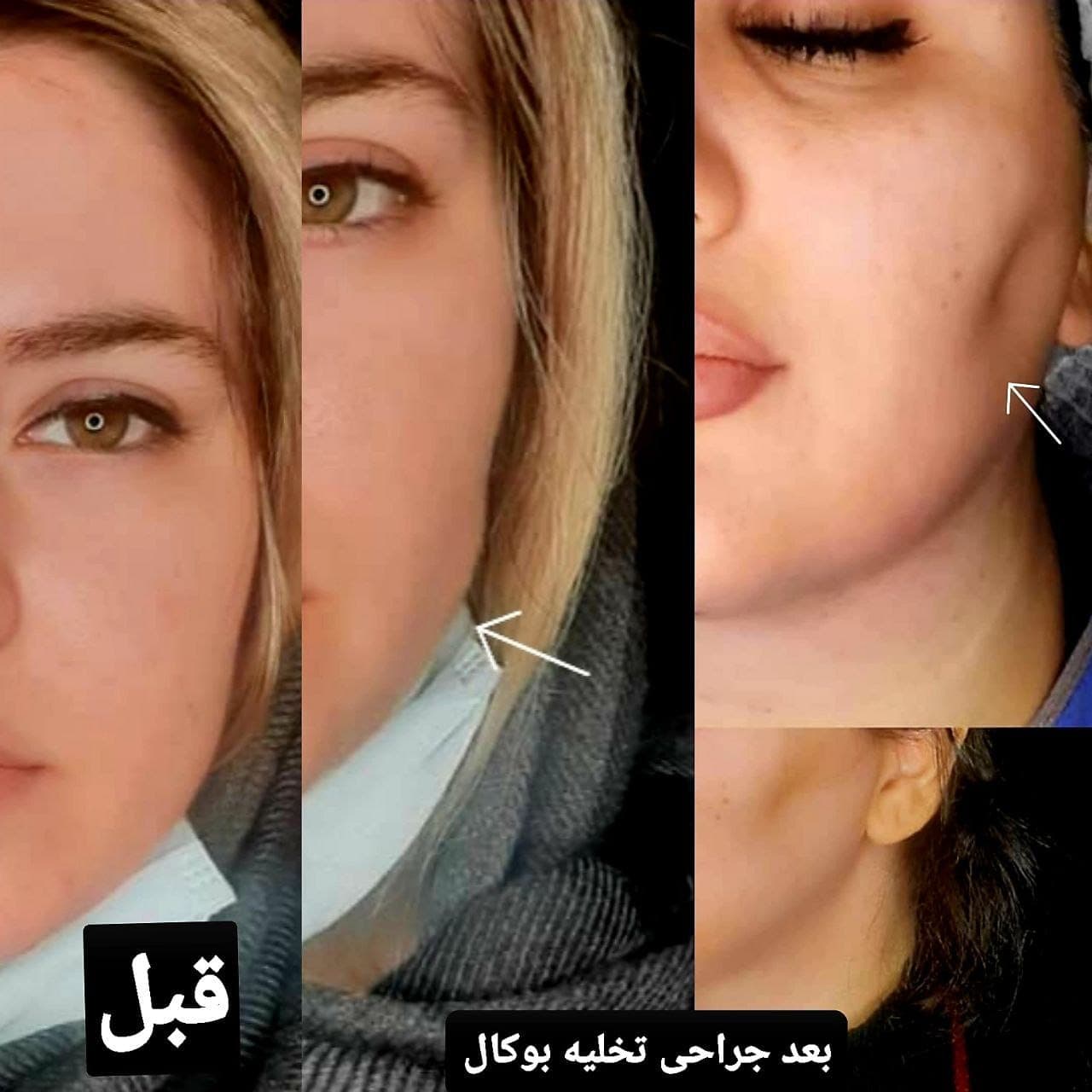 جراحی بینی و زیبایی صورت — نمونه