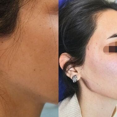 جراحی بینی و زیبایی صورت — نمونه