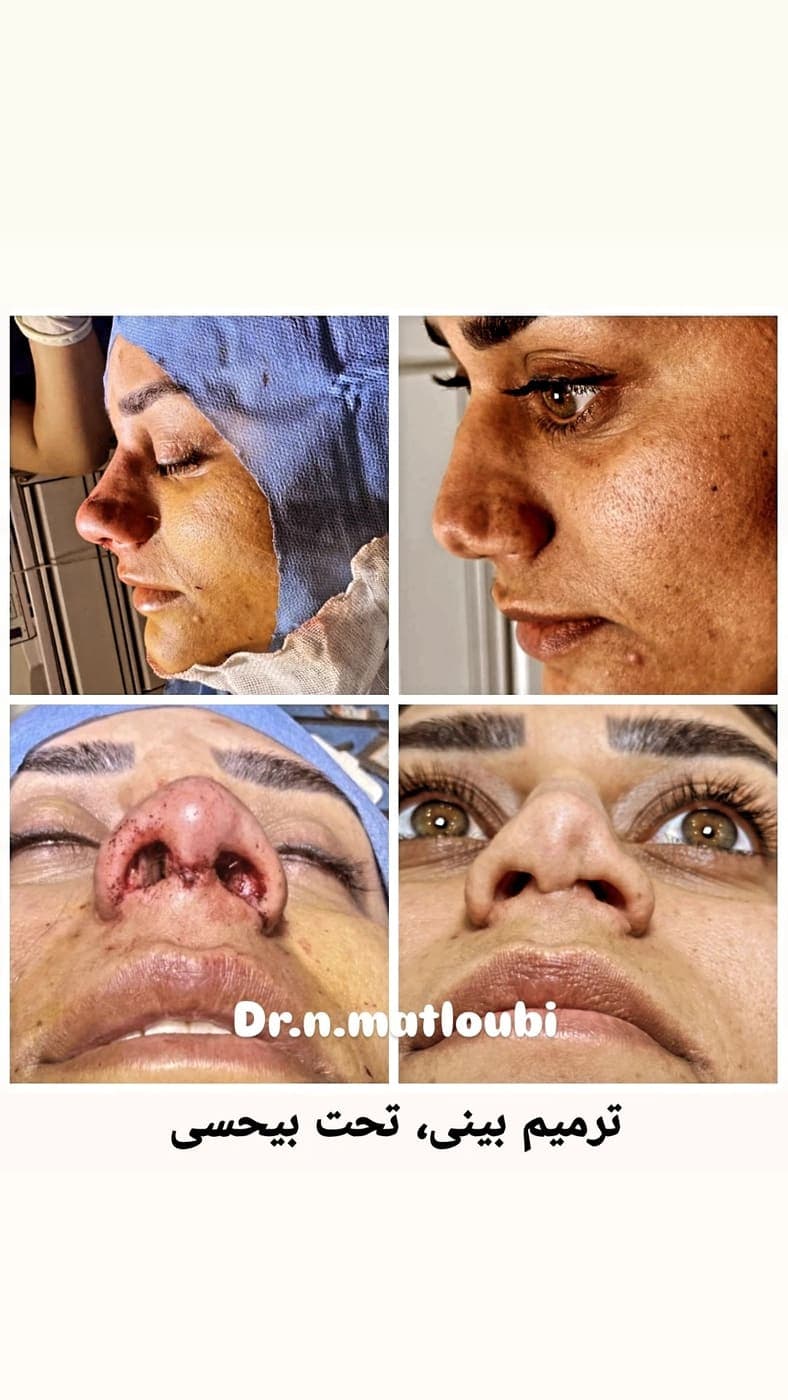 جراحی بینی و زیبایی صورت — نمونه 1
