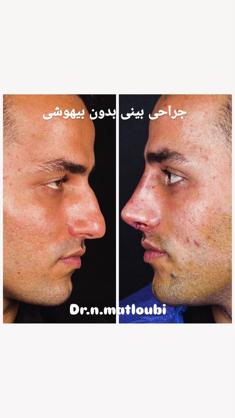 جراحی بینی و زیبایی صورت — نمونه 2