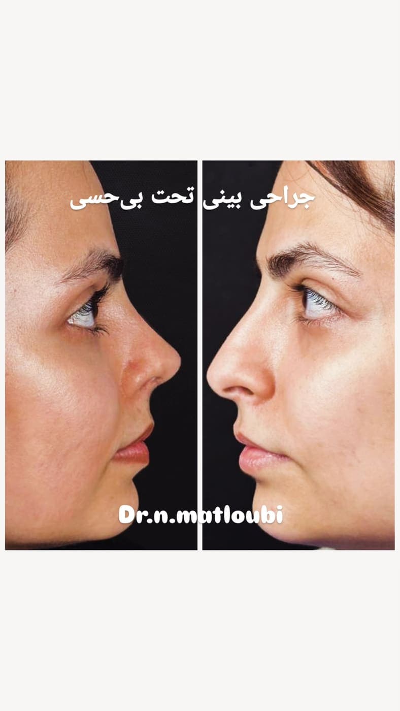 جراحی بینی و زیبایی صورت — نمونه 3