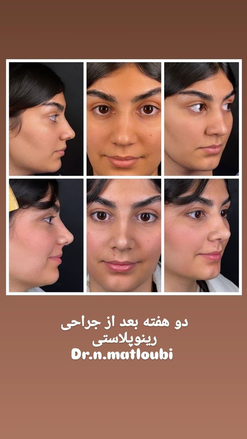 جراحی بینی و زیبایی صورت — نمونه 4