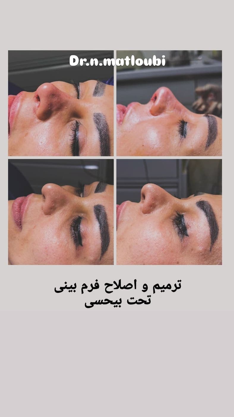 جراحی بینی و زیبایی صورت — نمونه 5