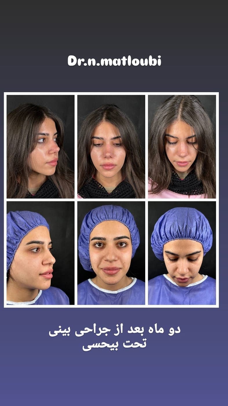 جراحی بینی و زیبایی صورت — نمونه 6