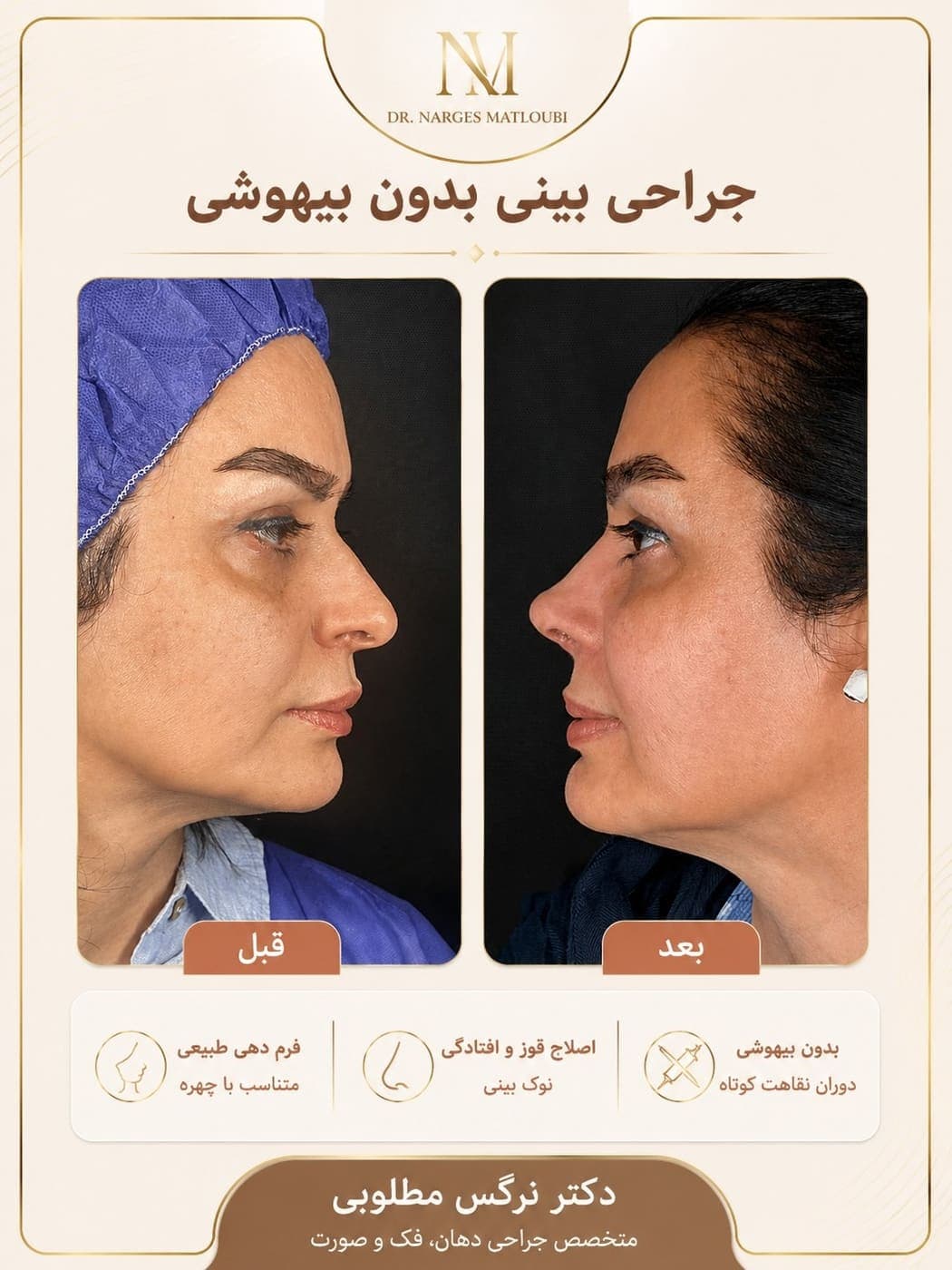 جراحی بینی و زیبایی صورت — نمونه 10