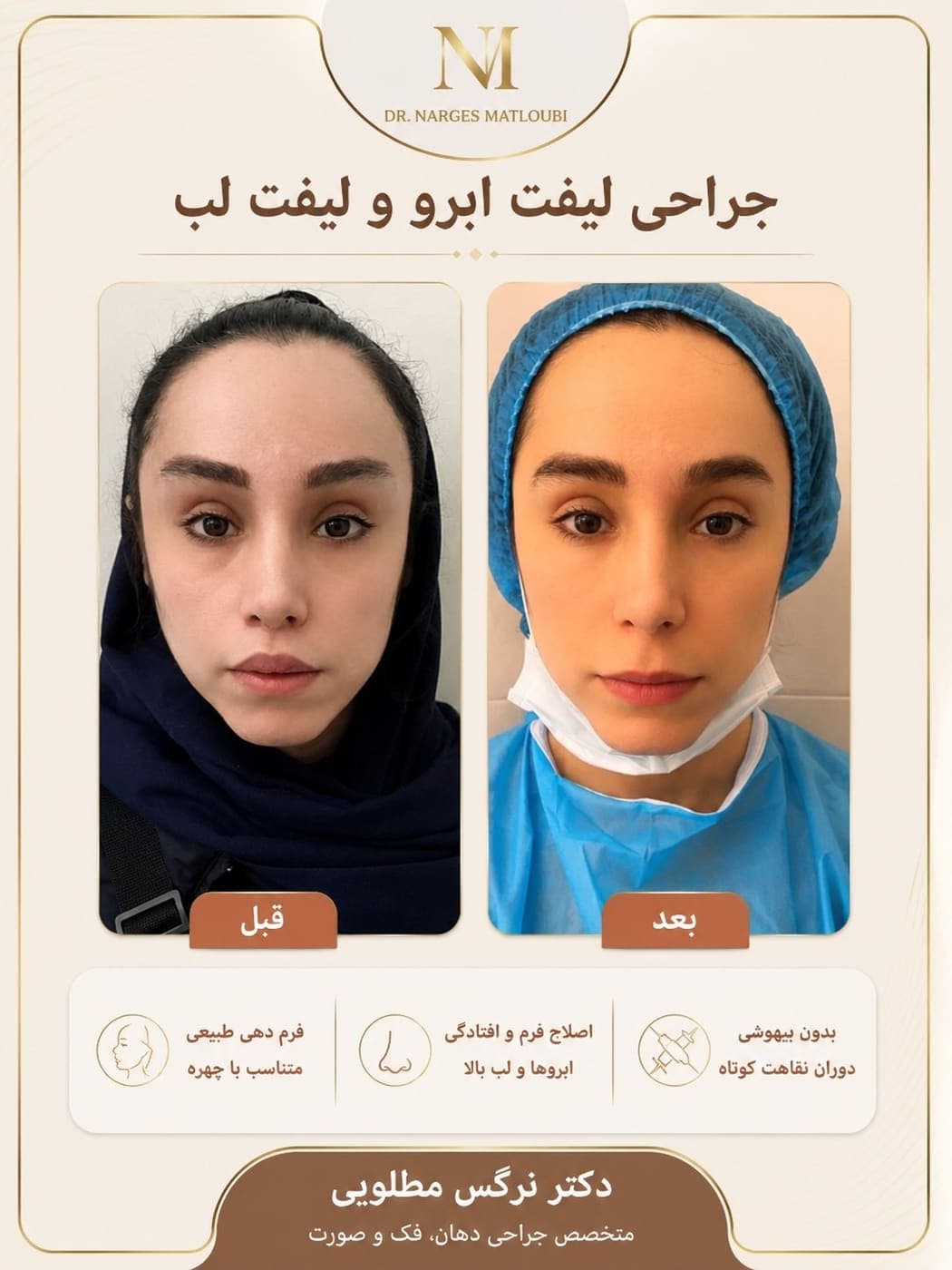 جراحی بینی و زیبایی صورت — نمونه 11
