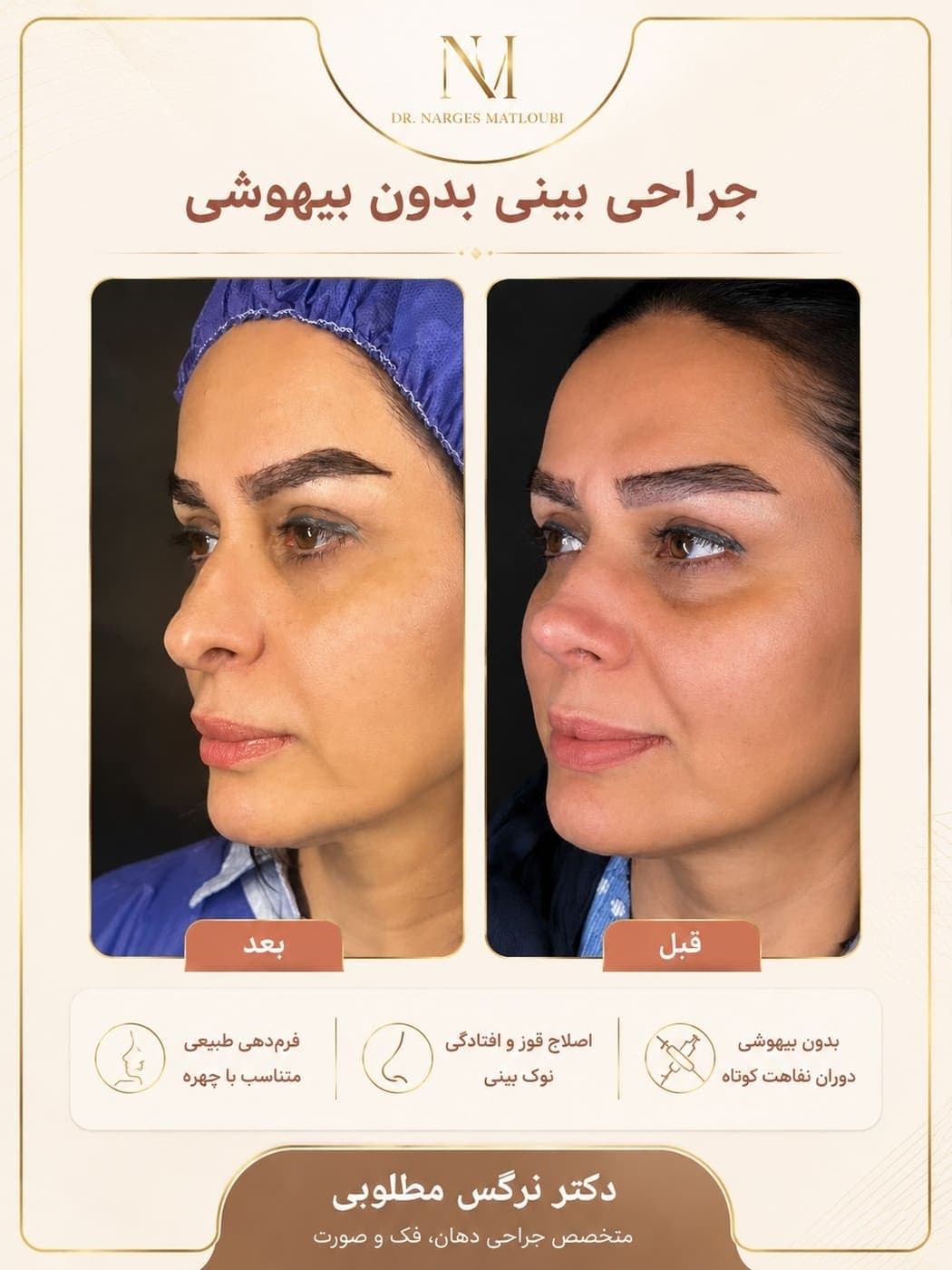 جراحی بینی و زیبایی صورت — نمونه 12