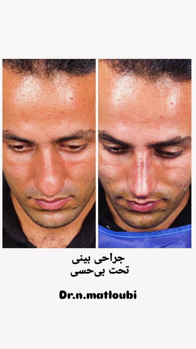 جراحی بینی و زیبایی صورت — نمونه 15