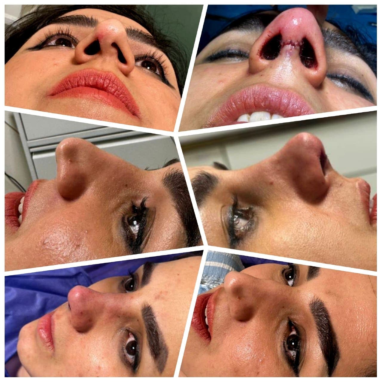 جراحی بینی و زیبایی صورت — نمونه 27