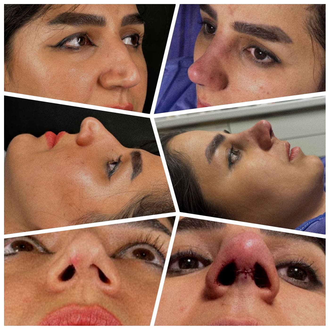 جراحی بینی و زیبایی صورت — نمونه 42