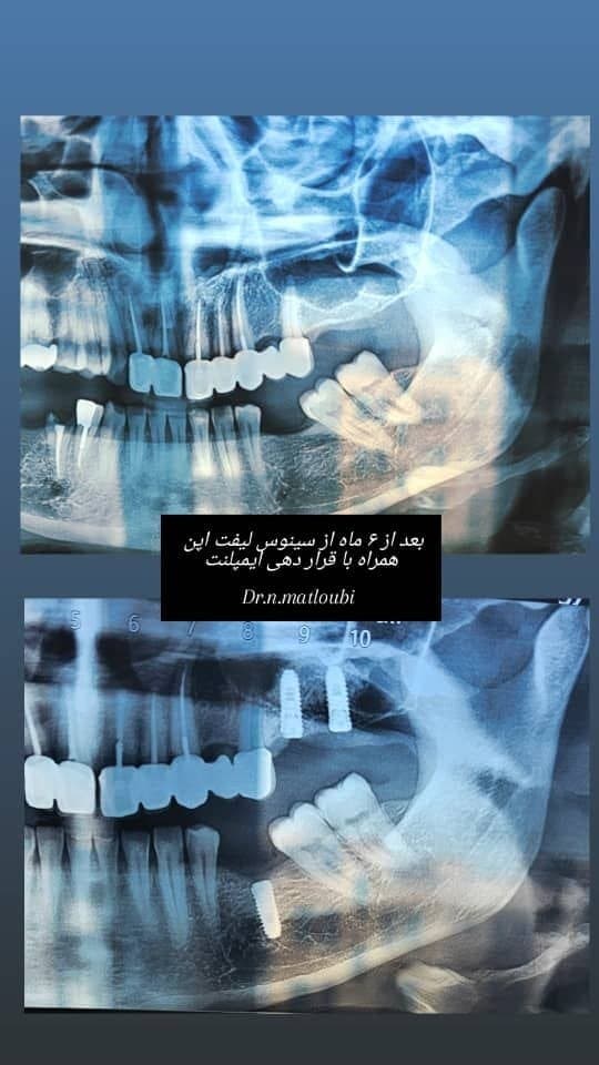 ایمپلنت و جراحی فک و صورت — نمونه 1